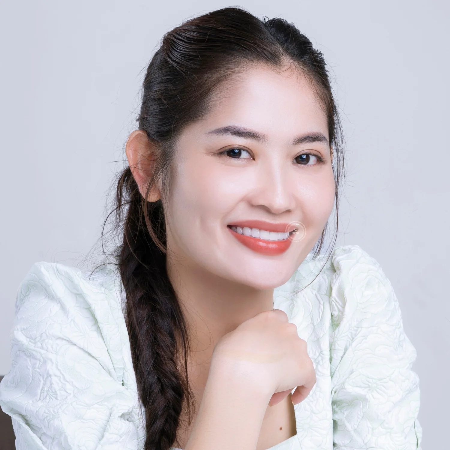 Tuổi thọ răng toàn sứ có thể kéo dài từ 15-20 năm hoặc lâu hơn